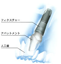 治療画像